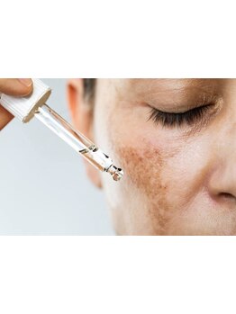 シミしわ改善！予防ケア