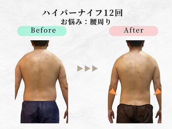 美容整体ウェリナ 中川八田院/小顔矯正/骨盤矯正/痩身整体