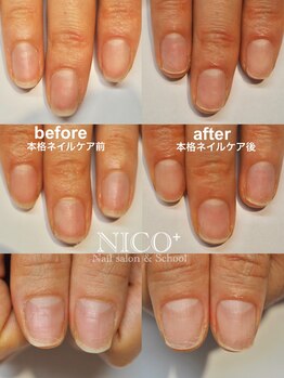 ニコプラス(NICO+)/ジェルネイルができない方向け