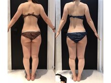 リボディ 表参道(An re Body)/before→after