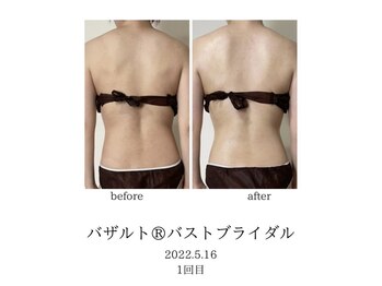 オン(On)/バザルトボディ１回目施術