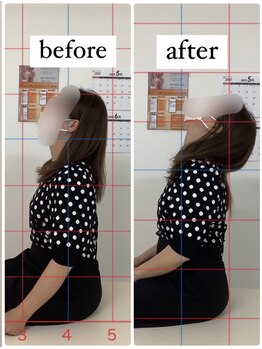 ナオル整体 仙台長町院(NAORU整体)/整体・矯正ビフォーアフター
