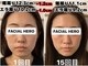 フェイシャルヒーロー(FACIAL HERO)の写真