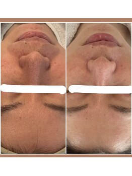 セレ(CELLE)/プラチナクレイピール