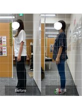 ナオル整体 武蔵小杉院(NAORU整体)/20代女性　腰痛