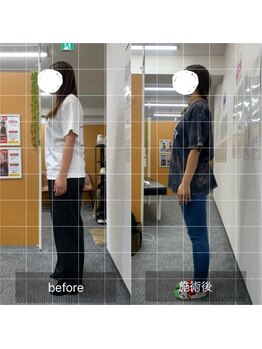 ナオル整体 武蔵小杉院(NAORU整体)/20代女性　腰痛