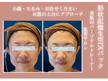 モルティープリマクラッセ 宇都宮東店(Molti Prima Classe)の雰囲気（小顔引締め・毛穴・たるみ・ニキビケアはBTX生パックで改善♪）
