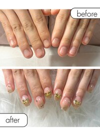 ◆深爪矯正+5ミリ長さだし◆