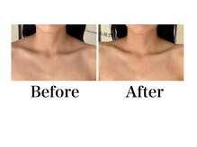 ハリムーン 仙台(harimoon)/ブライダル