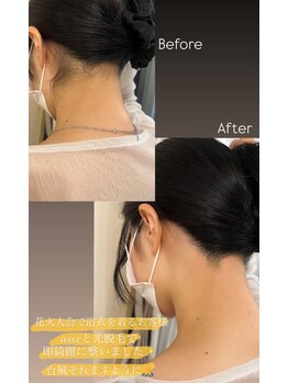 エリス(ELISSE)/うなじwaxで浴衣美人に!