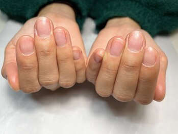 ワイドット(y.)の写真/自爪を育むケアで健やかな土台を整え、活き活きとした自爪をキープしながらネイルを楽しめる理想の爪質へ◎