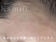 キスミー(Ksmiii)の雰囲気（WAXだけで終わらない！施術後のケアに特化！もちもちつるん美肌）