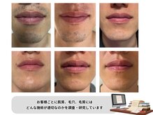 ビーディーラボ(B.D.Labo)の雰囲気（脱毛/毛穴/フェイシャル/顔脱毛/小顔/うなじ/木場/門前仲町/葛西）