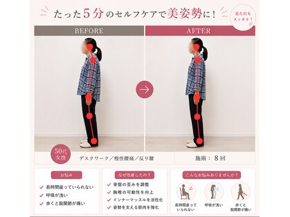 リビュース(ReBeauth)の写真