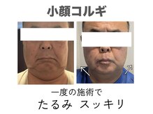 ファブ(Fab)の雰囲気（キャビテーションダイエット！理想の身体に♪）