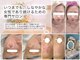 イリス(Iris)の写真