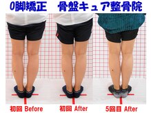 骨盤キュア整骨院/Ｏ脚矯正