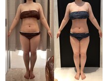 リボディ 表参道(An re Body)/before→after