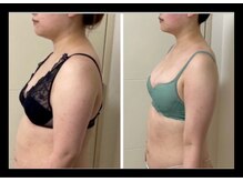 蒼(so)/7～8キロ以上減量希望→10~12回