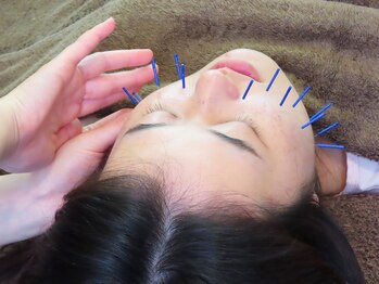 宮町鍼灸整骨院/美容鍼でよりよいお肌に♪