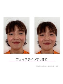 ペガサス トレーニングジム 八尾久宝寺店(Pegasus training gym)/小顔効果