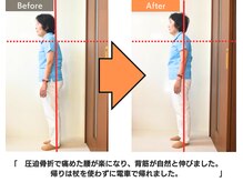 リップル オステオパシー整体院(RIPPLE)/姿勢の変化１