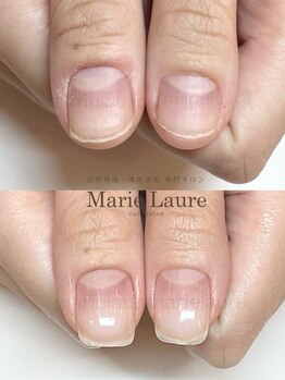 マリーロール 天王寺店(Marie Laure)/自爪育成/深爪矯正/ネイルケア