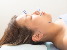 てんびんの雰囲気（美容鍼ですっきり小顔に◎しわ、たるみに効果的☆）