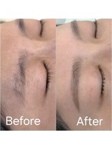 ビメ 中央林間(BEME)/Before・After