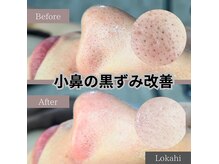 ロカヒ(Lokahi)の雰囲気（黒ずみ改善！毛穴洗浄♪完全個室で看板を持たない隠れ家サロン☆）