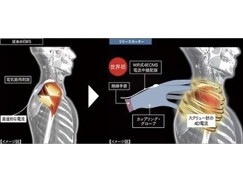 トラ 恵比寿店(TORA)/深層の癒着を狙い撃つ4D電流