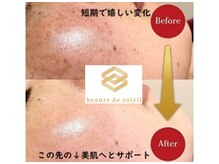 ボーテ デ ソレイユ(beaute de soleil)