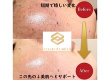 ボーテ デ ソレイユ(beaute de soleil)