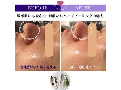 クレヴィア バイ サイバーエステ(CREBIA)の写真