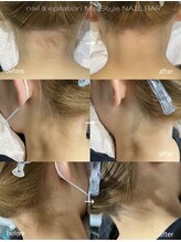 エムズスタイル ネイルバー(M's Style NAIL BAR)/うなじ脱毛