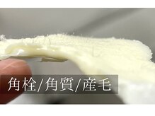 モイリープ(Moileep)/こんなに取れる！？