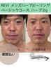 【再来】都度払い♪【MENS】REVI★むけない次世代ハーブピーリング★