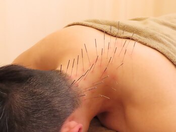 リサ鍼灸院(RISA鍼灸院)/ルート鍼