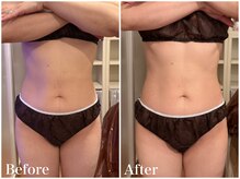 サロンドフェイス(Salon de Faith)/【リリースカッター】1回施術♪