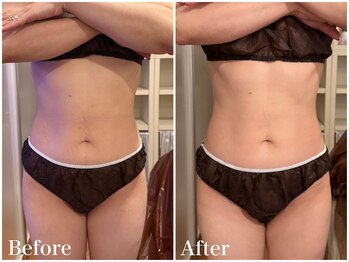 サロンドフェイス(Salon de Faith)/【リリースカッター】1回施術♪