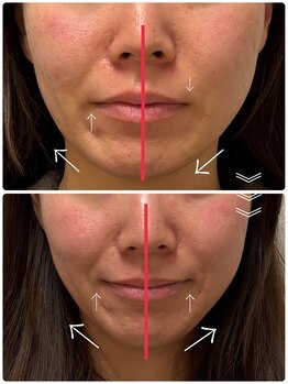 レモンローズ(Lemon Rose)/小顔矯正【小顔矯正　東住吉区】