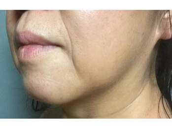 リンネ(Linne)の写真/「最近疲れて見える」「フェイスラインがぼやけてきた」そんな大人女性に根本からアプローチする本格ケア。