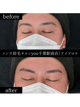 ユー 千葉駅前店(you)/ビフォ－アフター写真