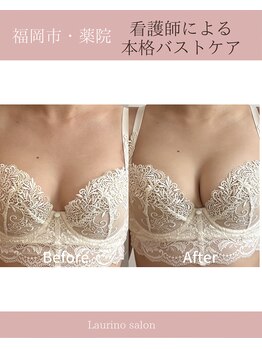 ラウリノサロン(Laurino salon)の写真/無理な勧誘&コースなし！歴17年の元看護師による知識&技術をお届け◇"貴女だけ"の特別なケアで美ボディに☆