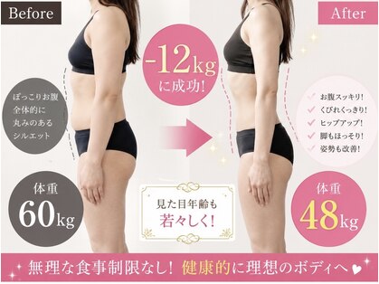 ラブグレイス(Lovegrace)の写真