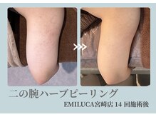 エミルカ 宮崎店(EMILUCA)の雰囲気（丁寧にカウンセリングして肌育計画♪すっぴんが怖くない美人肌に）