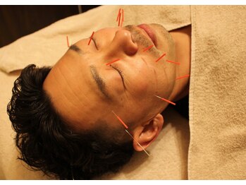 ここいろ/男性にも人気の美容鍼灸