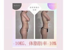 美ららの雰囲気（施術歴３万人の実績！ビフォーアフターブログ、インスタに連載中）