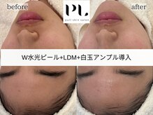 プル スキンサロン(pull skin salon)/