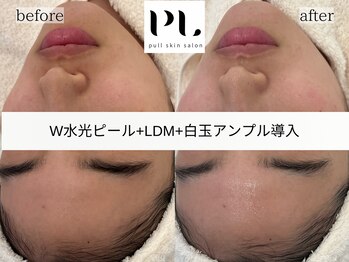 プル スキンサロン(pull skin salon)/